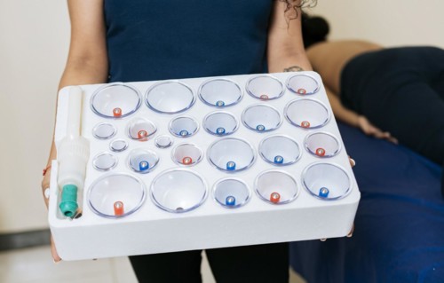 Physiotherapist hands holding cupping cups