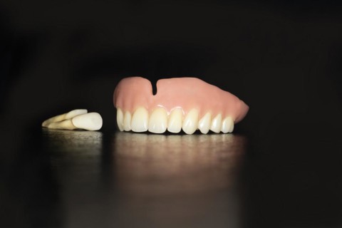 Denture upper jaw made of plastic with pulled teeth