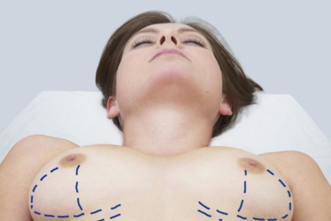 Breast surgery in preparation