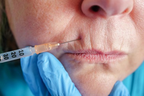 Older woman injected in lips Hyaluronic acid, Woman in beauty salon. plastic surgery clinic