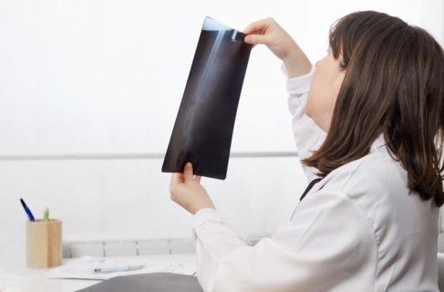 Young female doctor in profile looking at a patients x-ray with a white background