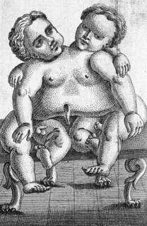 Siamese twins born in Palermo in 1755