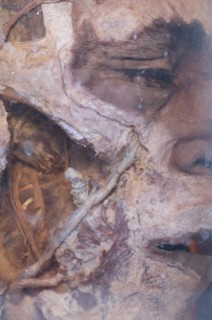 Closeup of a dead man's head preserved in a glass jar