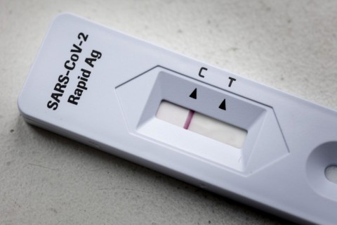Negative SARS-Cov-2 antigen test. Berlin