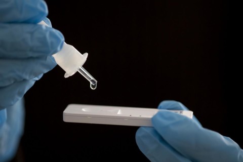 SARS-Cov-2 antigen test. Berlin