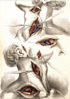 Medicine