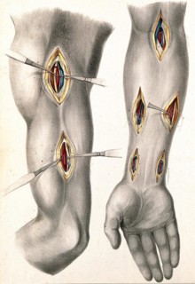 Medicine