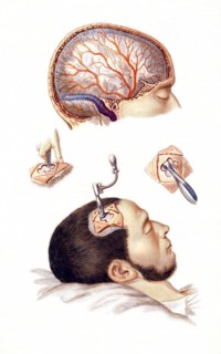 Medicine