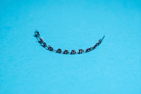 Fixed braces of a child on a blue background
