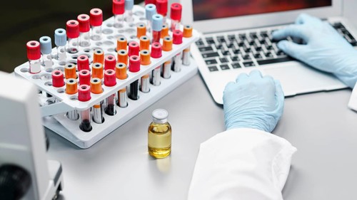 Female researcher laboratory with vaccine bottle test tubes