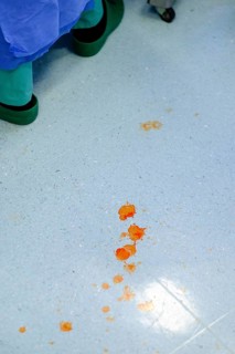 Blood spatter on the floor of an operating theatre in a hospital