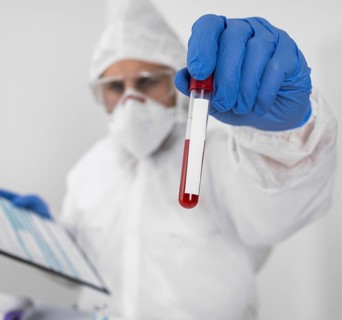 Doctor holding covid sample