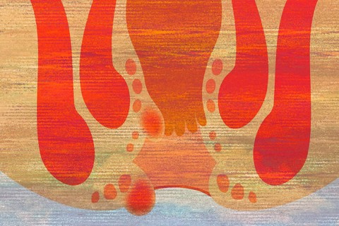 Haemorrhoids are the vascular cushions with a good blood supply that are located at the exit of the rectum. They sit a little above the anus and