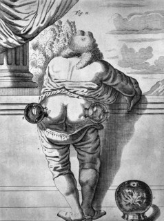 Illustration in the 1693 medical textbook Exercitationes practicae by Dutch doctor Frederick Dekkers