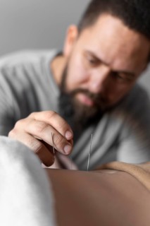 Close up therapist holding acupuncture needle