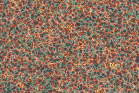 Shape of bacterial cell: cocci