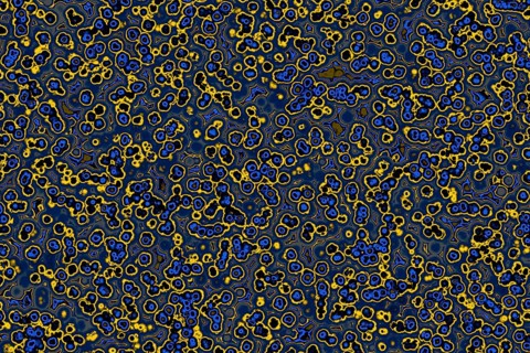Shape of bacterial cell: cocci