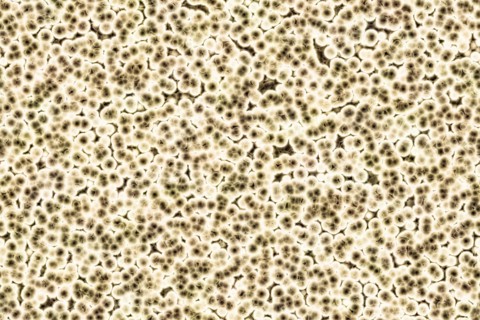 Shape of bacterial cell: cocci