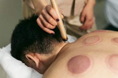 Suction cups therapy session close up