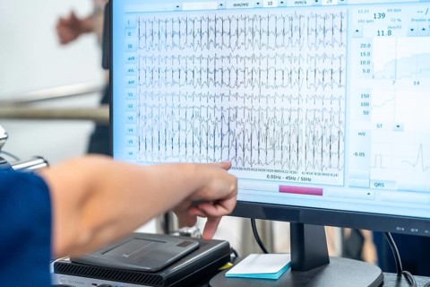 Cardiologist pointing to the data on the computer while man performing a cardiovascular stress test in the hospital