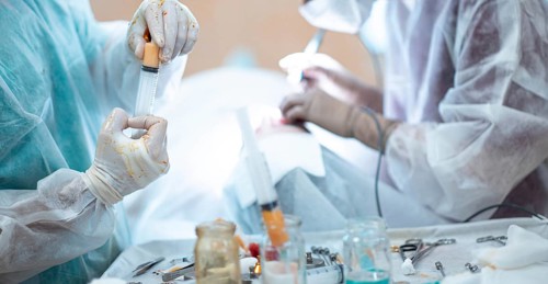 Liposuction and lipofilling concept