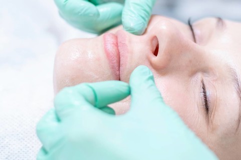 Portrait of a woman's face with problem skin. Peeling procedure. Natural beauty.