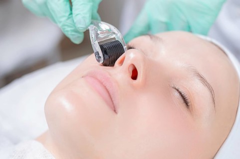 Portrait of a woman's face with problem skin. Peeling procedure. Natural beauty.