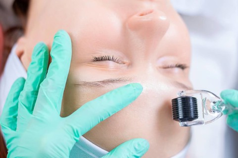 Portrait of a woman's face with problem skin. Peeling procedure. Natural beauty.