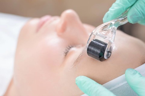 Portrait of a woman's face with problem skin. Peeling procedure. Natural beauty.