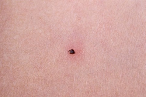 Castor bean tick