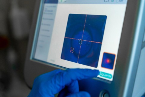Screen used by the ophthalmologist to monitor the eye for laser application during glaucoma