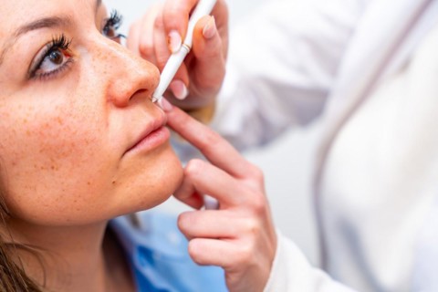 Close-up of the hands of a cosmetologist marking the points to inject hyaluronic acid on the