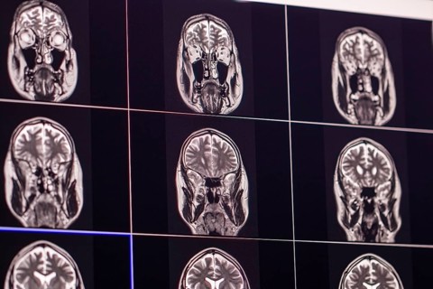 Several MRI images of a brain on screens showing medical analysis and diagnostics