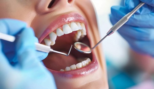 Woman with open mouth has teeth examined during checkup and fixed by a dentist in dental clinique,