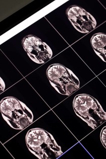 Multiple brain MRI scans on a monitor during a medical examination