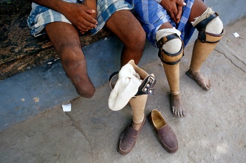 Two double leg amputees with leg prostheses, Jaipur, India. These prostheses are called Jaipur foot