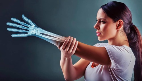 A woman holds her arm, shown in an X-ray image with visible bone structures, AI generated, AI