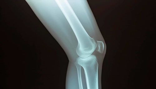 Lateral X-ray of a knee joint, AI generated, AI generated