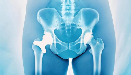 An image of a pelvis and hips in X-ray with clearly visible bone structures, AI generated, AI