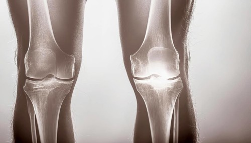 Bilateral X-ray of knee joints, AI generated, AI generated