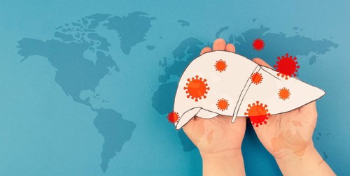 Liver organ infected with virus, world hepatitis day, diagnosis of cancer, cirrhosis health issue,