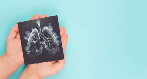 Lung with smoke, x-ray of the organ, world no tobacco day, unhealthy addiction, medical health risk