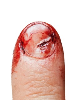 Physical injury blood wound human hand finger nail