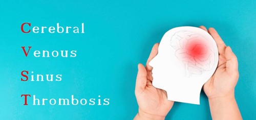 Cerebral venous sinus thrombosis is standing on the background, Silhouette of a head with a brain,