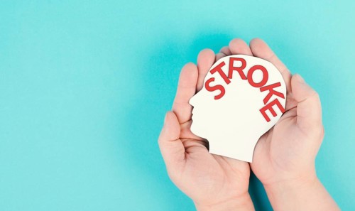 Holding a head with the word stroke in the hand, brain injury, ischemic and hemorrhagic types,