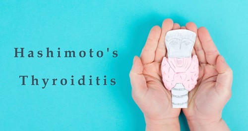 Hashimoto's thyroiditis, chronic lymphocytic disease, holding a thyroid organ, autoimmune symptoms,