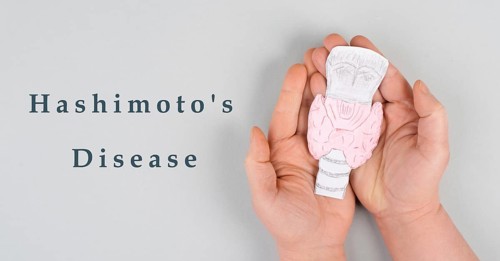 L Hashimoto's thyroiditis, chronic lymphocytic disease, holding a thyroid organ, autoimmune