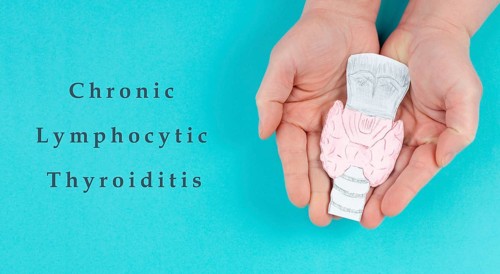 Hashimoto's thyroiditis, chronic lymphocytic disease, holding a thyroid organ, autoimmune symptoms,