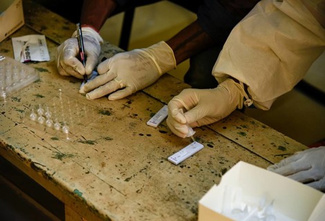 Health worker in personal protective equipment (PPE) collects a nasal swab sample from locals for