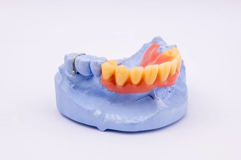 Removable denture of an upper jaw, denture, denture, dentist, dental impression